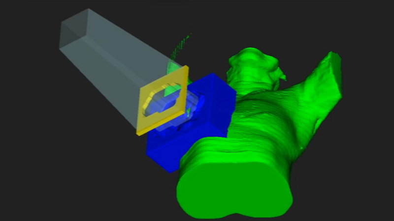 人体和医疗设备 3D 模型